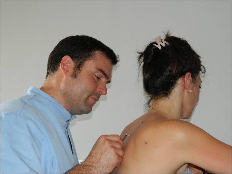 moxibustion_japonaise_sionneau2